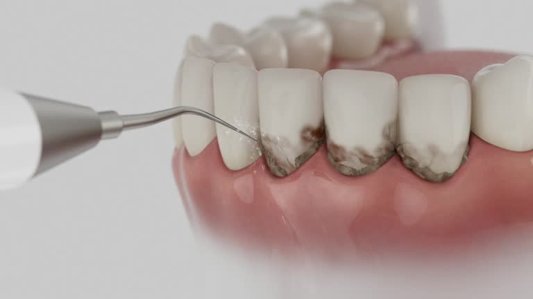 Reliable Tooth Extraction contractor in Mobile, AL by Smile Center Dentistry